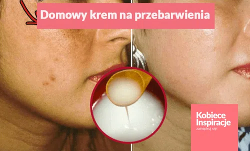 Domowy krem rozjaśniający przebarwienia – bez chemii i konserwantów