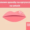 Domowe sposoby na opryszczkę na ustach - 5 SPRAWDZONYCH METOD