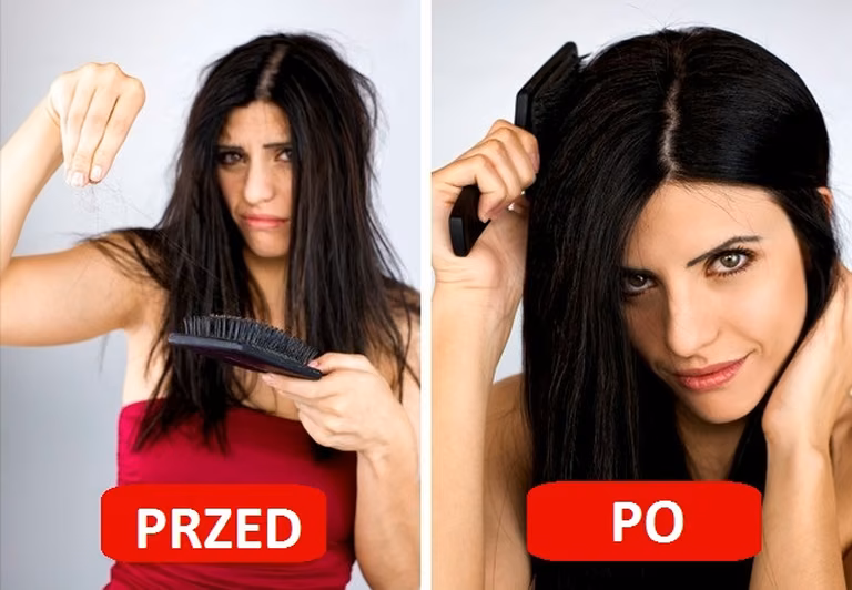 Jak powstrzymać WYPADANIE WŁOSÓW?