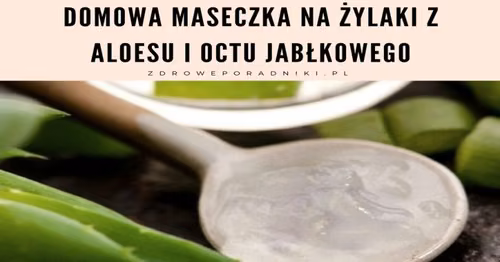 Domowa maseczka na żylaki z aloesu i octu jabłkowego