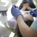 NFZ zapłaci za usługi dentystyczne! Jakie zabiegi będą za darmo?