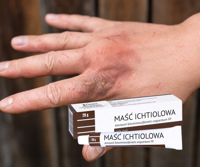 Maść ichtiolowa - HIT z apteki za 5 zł! Bez recepty!