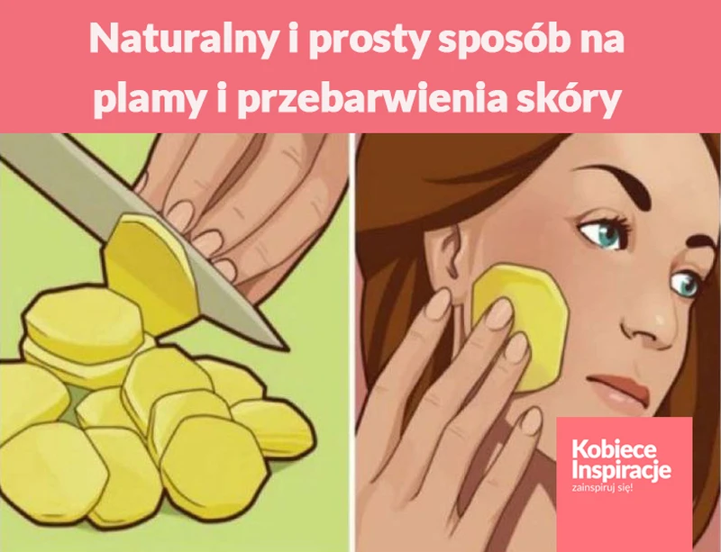 Naturalny i prosty sposób na plamy i przebarwienia skóry