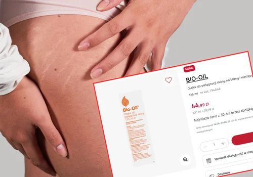 Ten olejek z Rossmanna to mega hit Polek! Teraz aż o 20 zł taniej, a rozstępy nie mają z nim szans