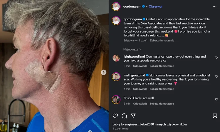 Zdjęcie Gordon Ramsay zszokował fanów nowym zdjęciem. Jego apel nie pozostawia wątpliwości! #1