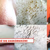 Poznaj 2 najlepsze sposoby na ZASKÓRNIKI
