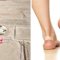 Jak rozciągnąć CIASNE BUTY?