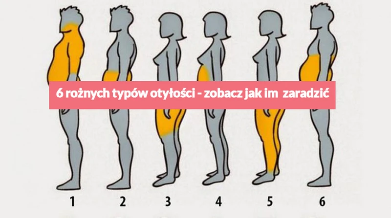 6 rożnych typów otyłości - zobacz jak im zaradzić.