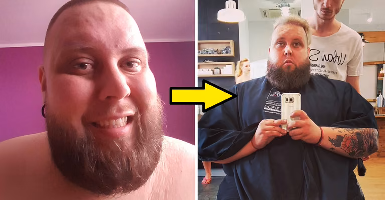 Gwiazda “Googlebox” pozuje nago po zrzuceniu 160 kilogramów!