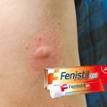 10 zastosowań Fenistil żelu. Działa bardzo szybko i przynosi znaczną ulgę.