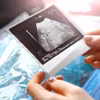 Czym są badania prenatalne ciąży? Czy są refundowane?