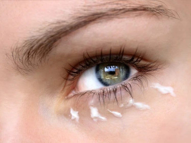Zdjęcie Dlaczego skóra wokół oczu jest podrażniona? Sprawdź możliwe przyczyny! #3