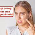 Co Twoja TWARZ zdradza o Twoim zdrowiu?