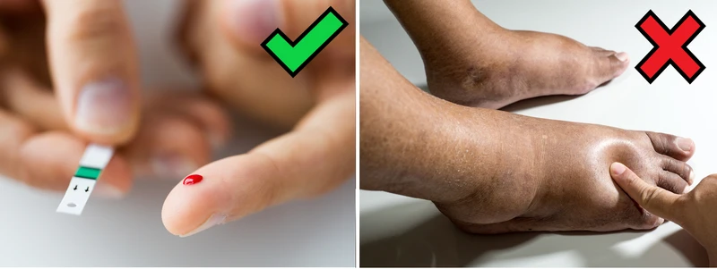 Domowy test na poziom cukru we krwi - kup w aptece. Zadbaj o zdrowie