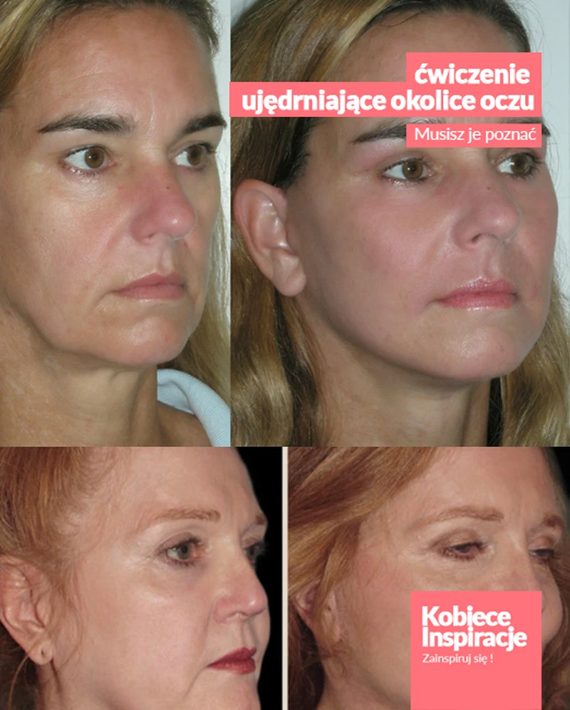 Face Fitness – ćwiczenie ujędrniające okolice oczu. [video]
