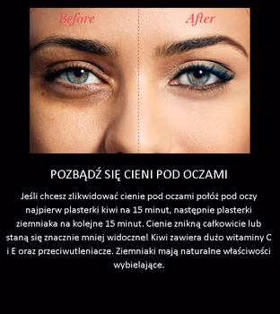 Jak pozbyć się ceni pod oczami