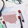 Zniesienie stanu zagrożenia epidemiologicznego w Polsce. Co się zmieni w przepisach?