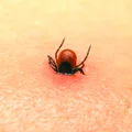 Uwaga na kleszcze! Zaczęły roznosić nową chorobę