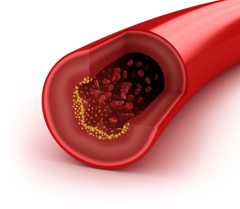 Sposób na obniżenie cholesterolu!