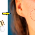 Kosmetyki z tym składnikiem działają cuda. Czy wiesz, czym jest retinol?
