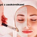 Jak walczyć z zaskórnikami