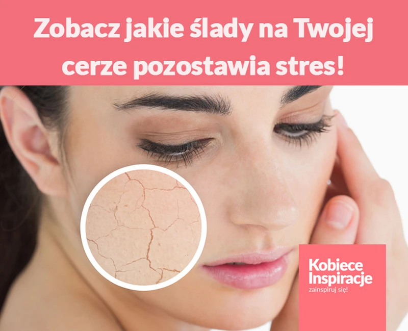Zobacz jakie ślady na Twojej cerze pozostawia stres!