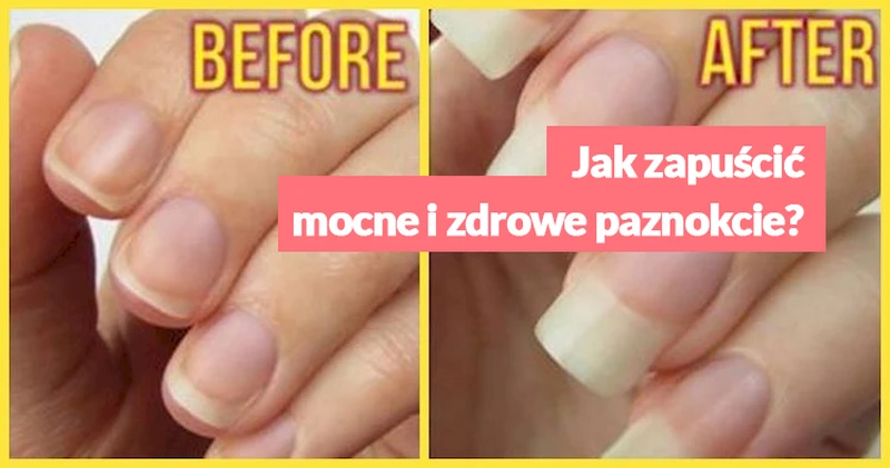 Jak zapuścić mocne i zdrowe paznokcie?