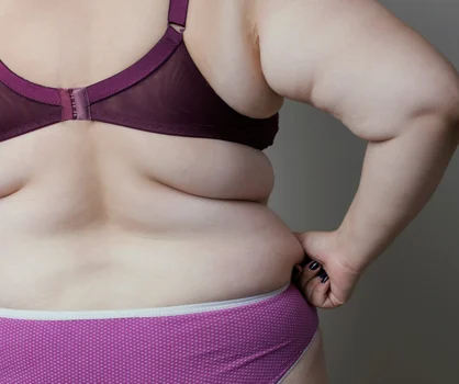 Czy otyłe osoby mogą cierpieć na niedożywienie? Prawda, mit czy coś pośredniego?