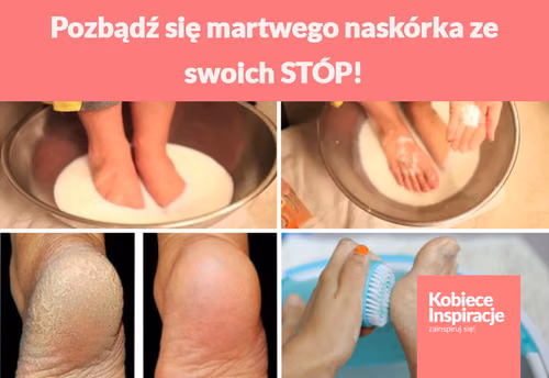 Pozbądź się martwego naskórka ze swoich STÓP!