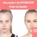 Jak pozbyć się WORKÓW POD OCZAMI?