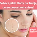 Zobacz jakie ślady na Twojej cerze pozostawia stres!