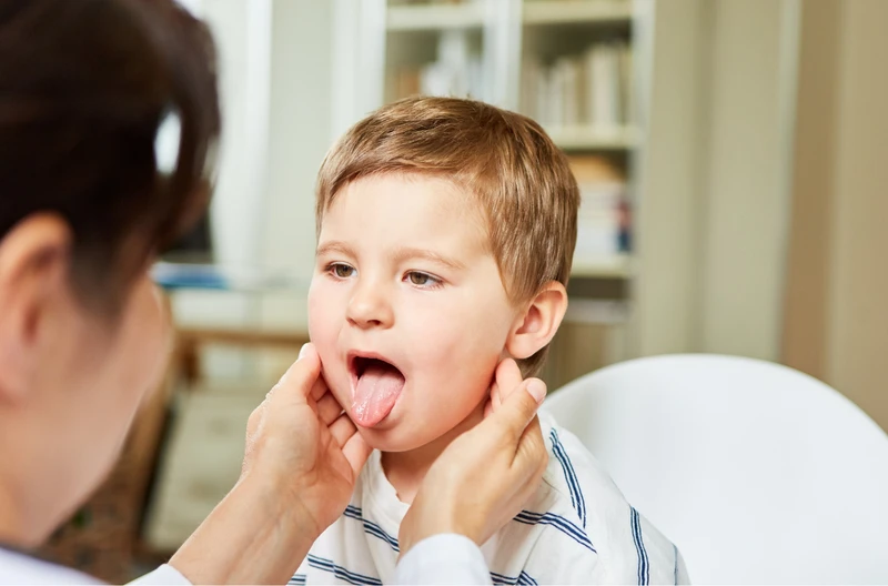 Angina: Bakteryjna czy Wirusowa? Jak je odróżnić? Kiedy antybiotyk? Sprawdź!
