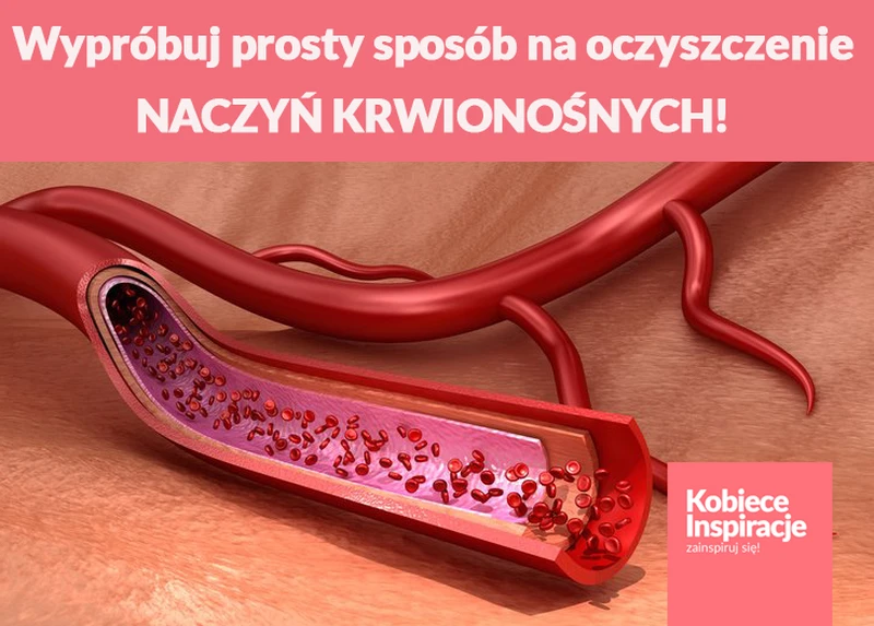Wypróbuj prosty sposób na oczyszczenie NACZYŃ KRWIONOŚNYCH!