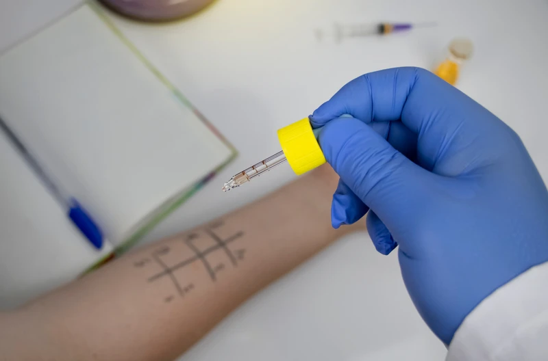 Co warto wiedzieć przed wizytą u alergologa?  Jak wyjść z gabinetu z rozwiązaniem, nie kolejną wizytą