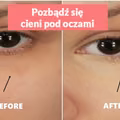 Jeden składnik, dzięki któremu pozbędziesz się cieni pod oczami