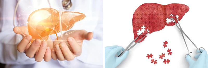 DIETA WĄTROBOWA – co to jest i kiedy stosować?