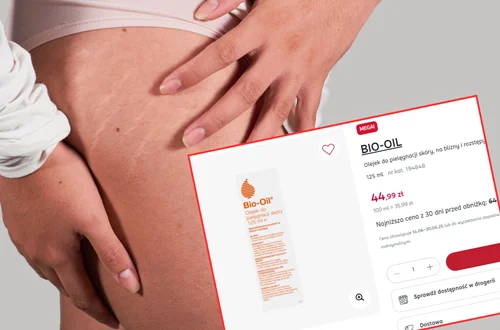 Ten olejek z Rossmanna to mega hit Polek! Teraz aż o 20 zł taniej, a rozstępy nie mają z nim szans
