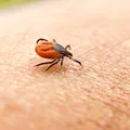 Czy można mieć alergię na kleszcze?  Jak ją rozpoznać?