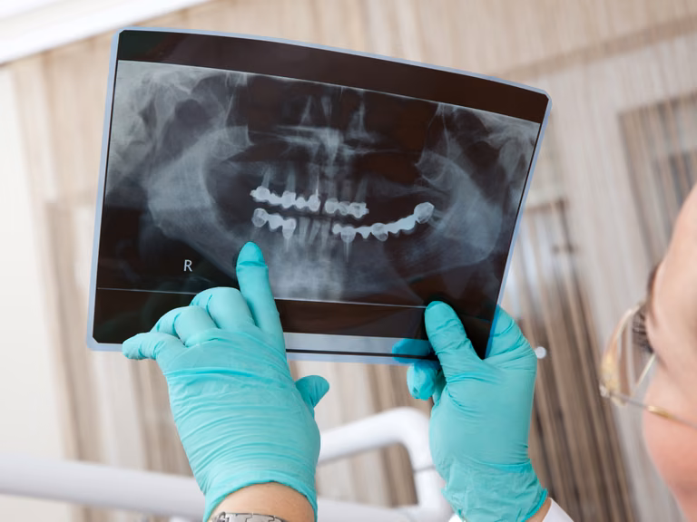 Usługi dentystyczne na NFZ! Więcej darmowych zabiegów już w tym roku! (LISTA)