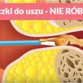 Czyścisz uszy patyczkiem? Sprawdź, dlaczego powinnaś przestać