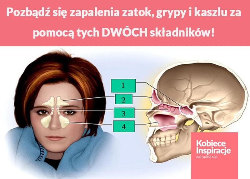 Pozbądź się zapalenia zatok, grypy i kaszlu za pomocą tych DWÓCH składników!