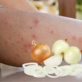 Odkryj potencjał cebuli! 11 zaskakujących zastosowań, które odmienią twoje codzienne życie!