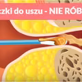 Czyścisz uszy patyczkiem? Sprawdź, dlaczego powinnaś przestać