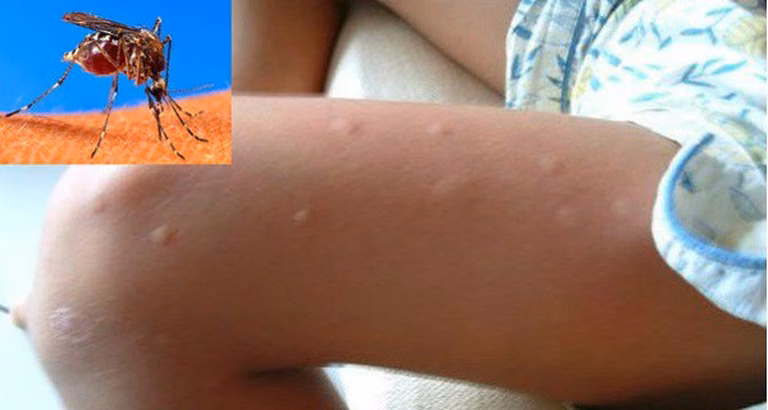 Jak przygotować naturalny i skuteczny spray na komary?