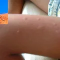 Jak przygotować naturalny i skuteczny spray na komary?
