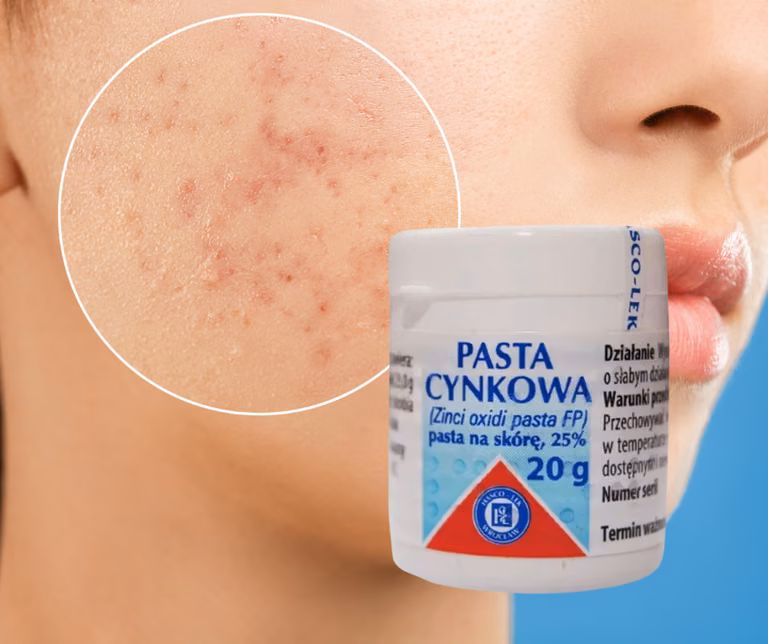 Pasta cynkowo- HIT z apteki za 5 zł!