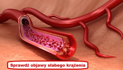Te oznaki mogą świadczyć o ZŁYM KRĄŻENIU