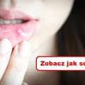 AFTY – domowa kuracja która przynosi ulgę
