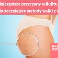 Najczęstsze przyczyny cellulitu i najskuteczniejsze metody walki z nim!