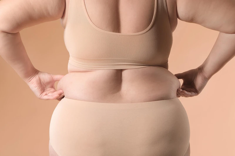 Otyłość - pandemia XXI wieku / WYWIAD z dietetyk dr Hanną Stolińską